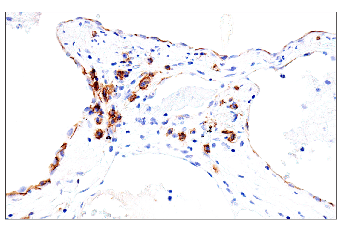 Immunohistochemistry Image 5: Syndecan 1 (E7F7T) Rabbit mAb