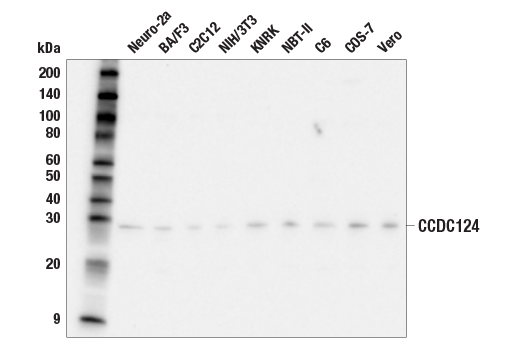Western Blotting Image 2: CCDC124 (E2G4Q) Rabbit mAb