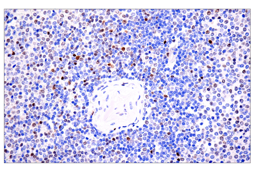 undefined Image 71: Human Exhausted CD8<sup>+</sup> T Cell IHC Antibody Sampler Kit