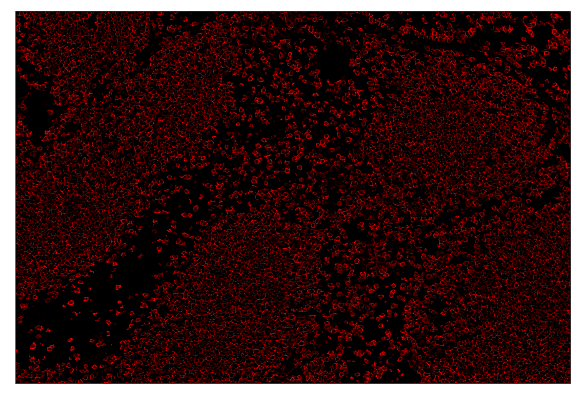 Immunohistochemistry Image 4: CD20 (E3N7O) & CO-0134-750 SignalStar<sup>™</sup> Oligo-Antibody Pair