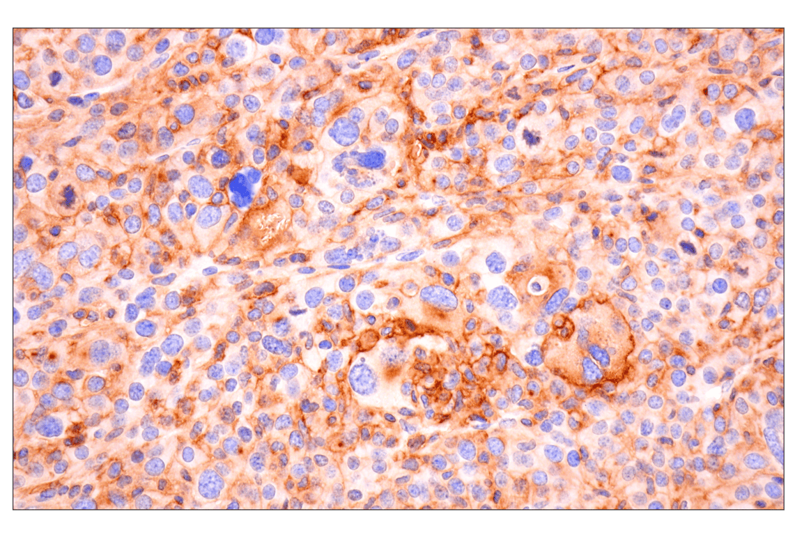 Immunohistochemistry Image 2: CD14 (D1U2Y) Rabbit mAb