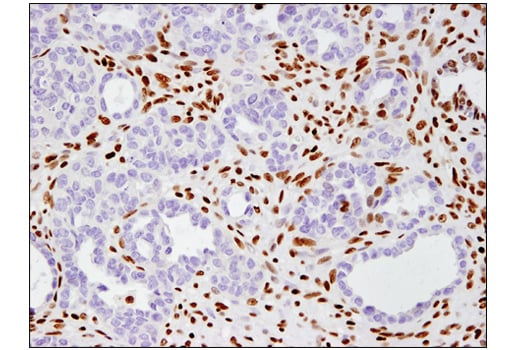 undefined Image 23: BAF Complex IHC Antibody Sampler Kit