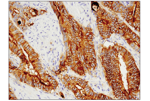 Immunohistochemistry Image 1: Tissue Factor/CD142 (E9M6T) XP<sup>®</sup> Rabbit mAb