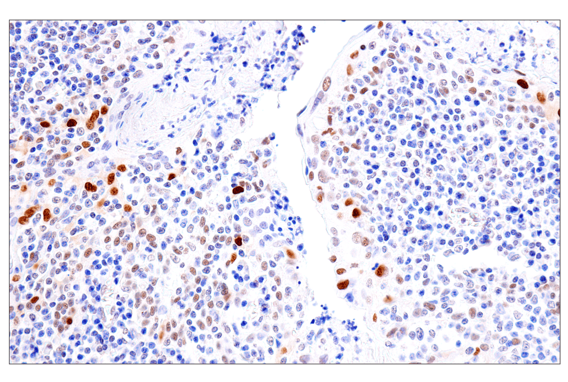 Immunohistochemistry Image 15: FoxA1/HNF3α (IHC578) Mouse mAb
