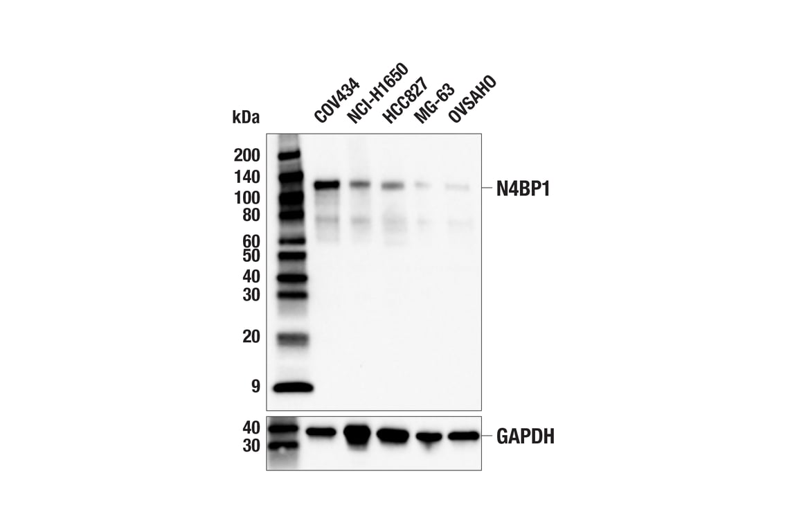 Western Blotting Image 2: N4BP1 (E8H5E) Rabbit mAb