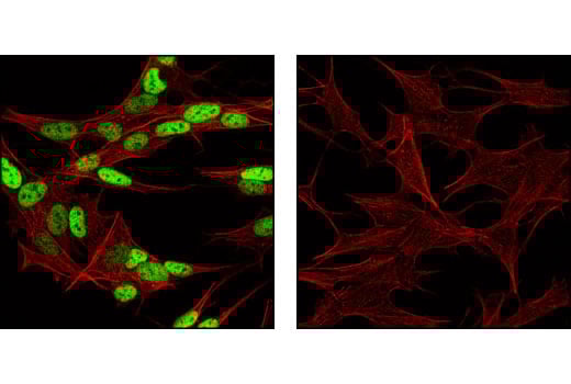 Immunofluorescence Image 1: AP-2β Antibody