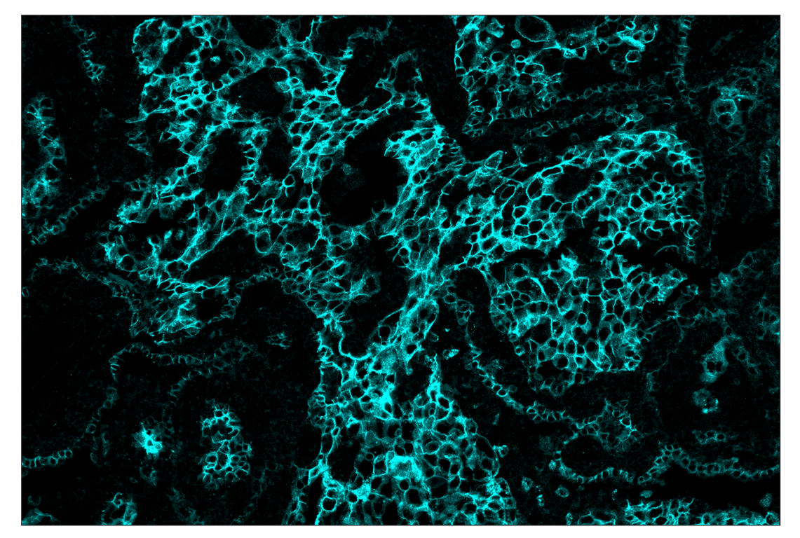 Immunohistochemistry Image 5: HER2/ErbB2 (D8F12) & CO-0059-488 SignalStar<sup>™</sup> Oligo-Antibody Pair
