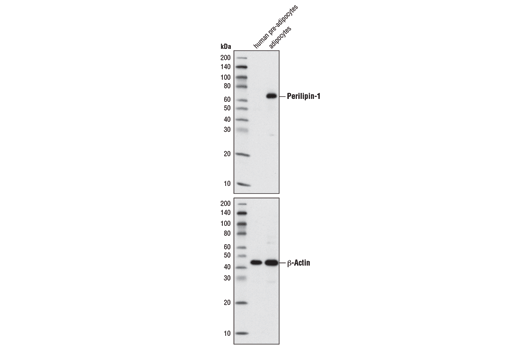 Western Blotting Image 1: Perilipin-1 (D1D8) XP® Rabbit mAb