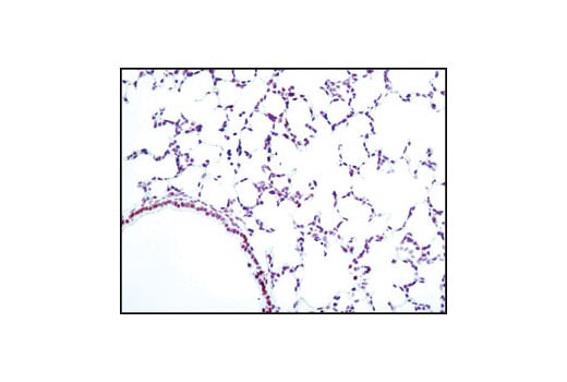 undefined Image 7: PhosphoPlus<sup>®</sup> CREB (Ser133) Antibody Duet