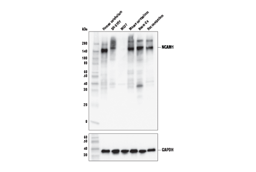 Western Blotting Image 1: NCAM1 (CD56) (E7X9M) XP<sup>®</sup> Rabbit mAb