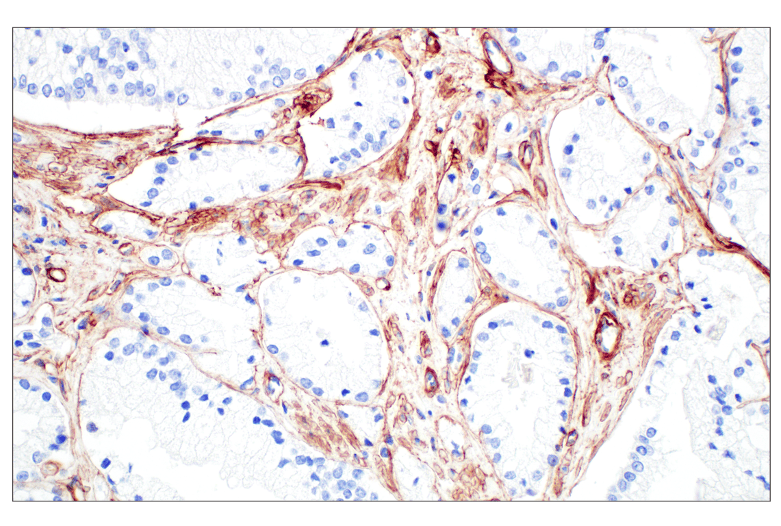 Immunohistochemistry Image 2: COL4A1 (E5M6R) Rabbit mAb (BSA and Azide Free)