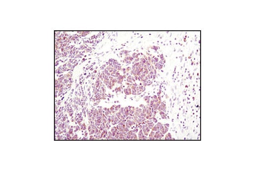 undefined Image 26: Pro-Apoptosis Bcl-2 Family Antibody Sampler Kit II