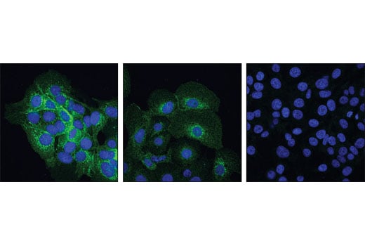 undefined Image 25: Lung Cancer RTK Antibody Sampler Kit