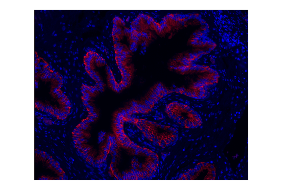 Immunohistochemistry Image 1: CD38 (E7Z8C) XP<sup>®</sup> Rabbit mAb (Alexa Fluor<sup>®</sup> 555 Conjugate)