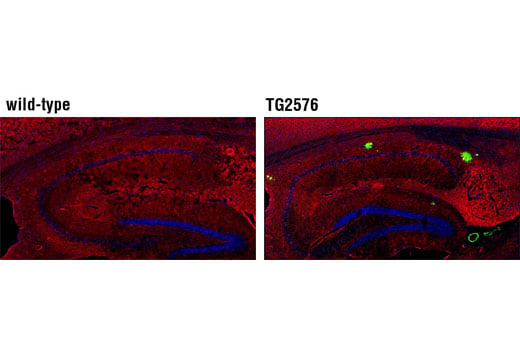 Immunofluorescence Image 1: β-Amyloid (1-40) (D8Q7I) Rabbit mAb (BSA and Azide Free)