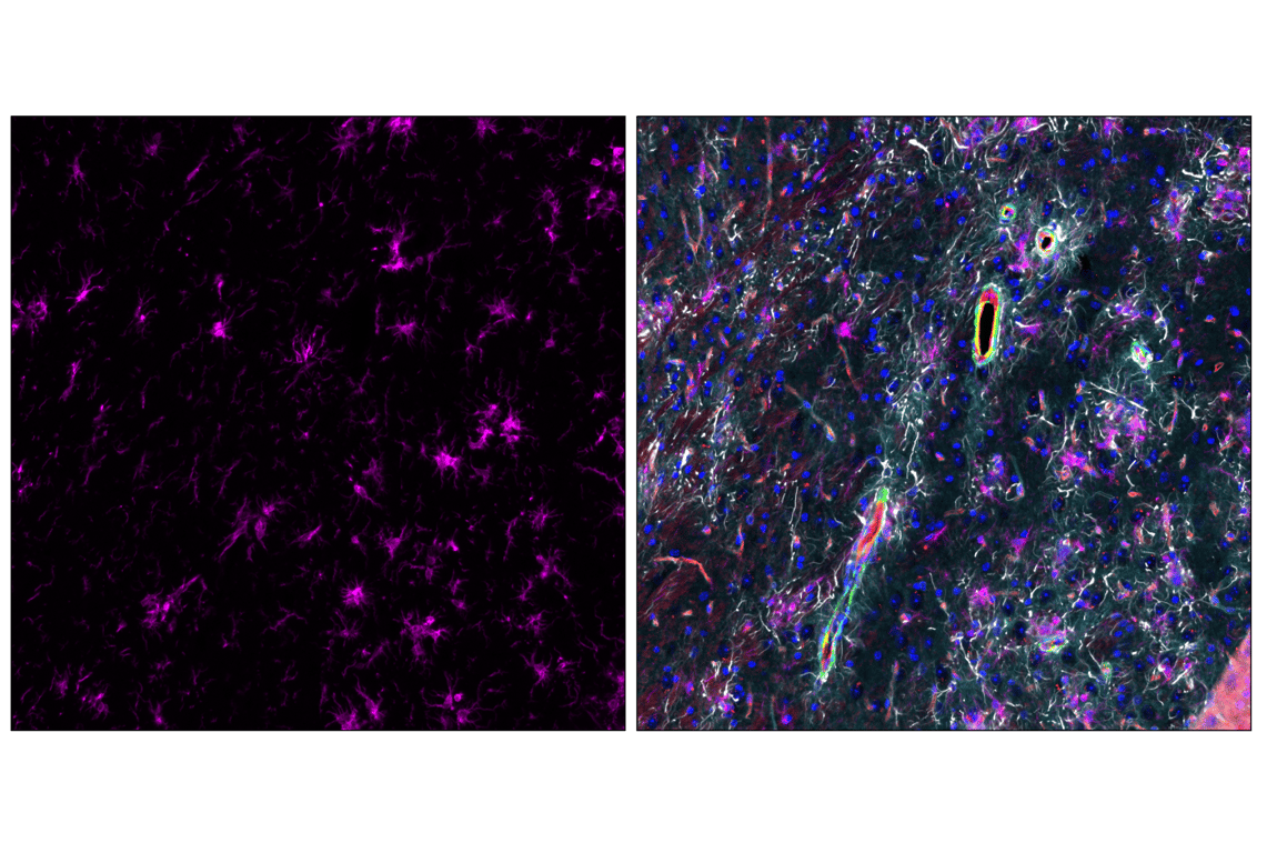 Immunofluorescence Image 5: Iba1/AIF-1 (E4O4W) XP<sup>®</sup>  Rabbit mAb (Alexa Fluor<sup>®</sup> 647 Conjugate)