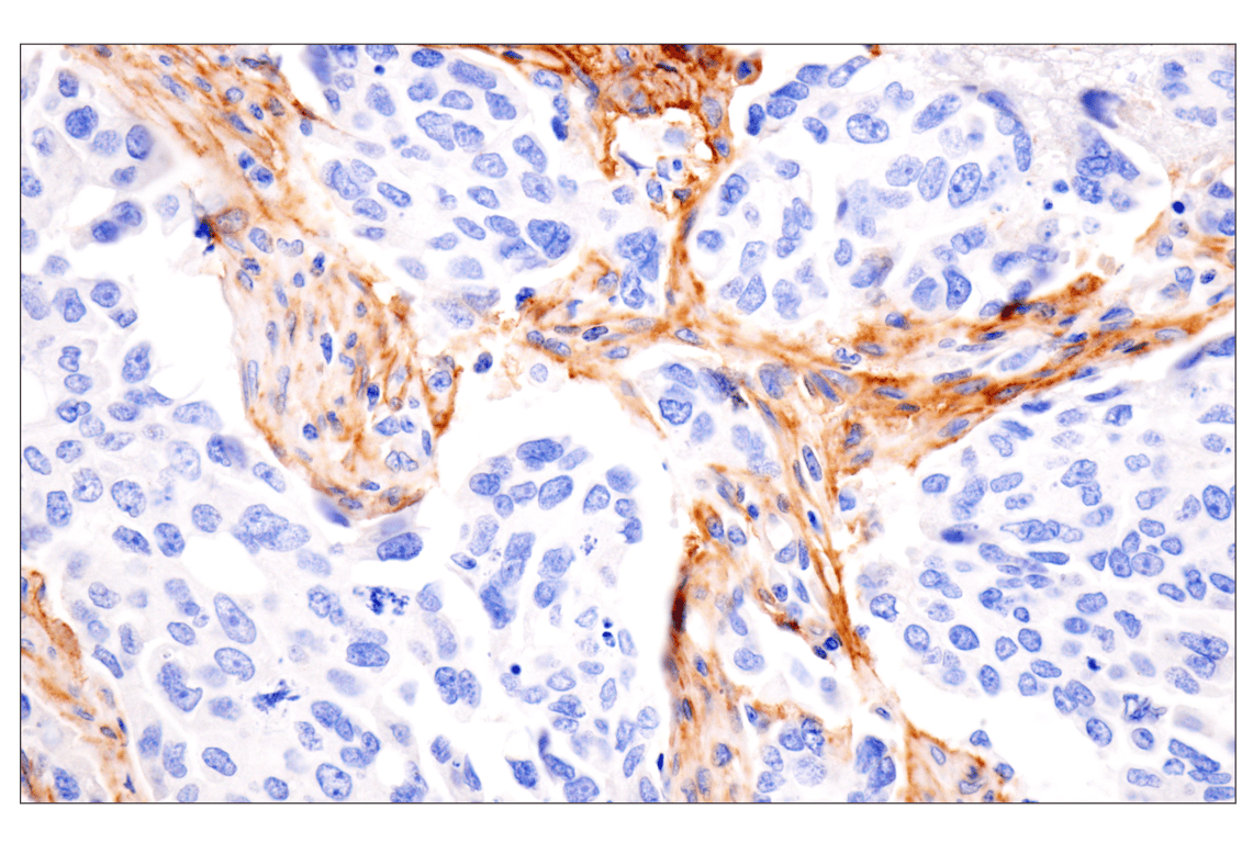 Immunohistochemistry Image 5: LRRC15 (E4X8J) Rabbit mAb