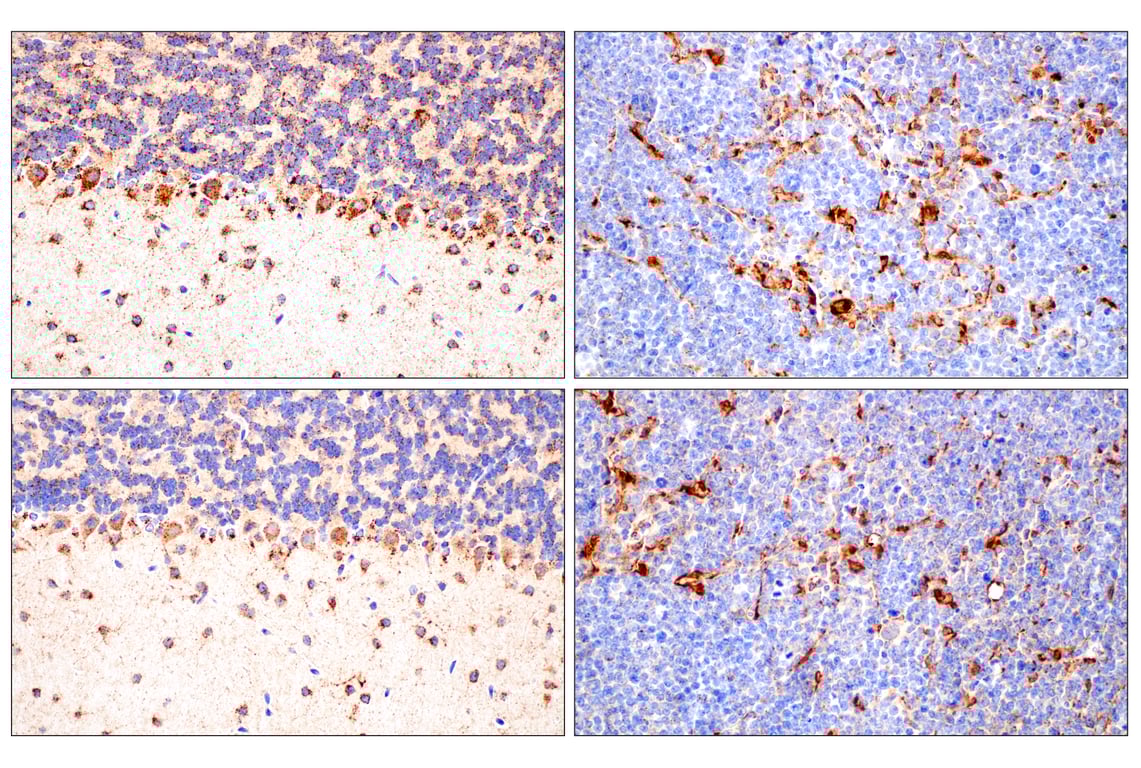 Immunohistochemistry Image 12: Cathepsin D (E5V4H) Rabbit mAb