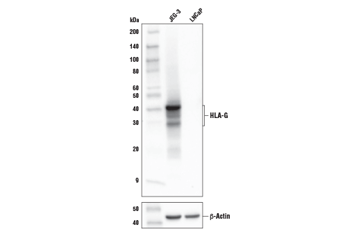 Western Blotting Image 1: HLA-G (E8N9C) XP<sup>®</sup> Rabbit mAb