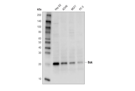 undefined Image 36: Pro-Apoptosis Bcl-2 Family Antibody Sampler Kit II