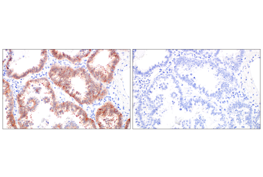 Immunohistochemistry Image 7: Integrin β6 (E4M9P) XP<sup>®</sup> Rabbit mAb
