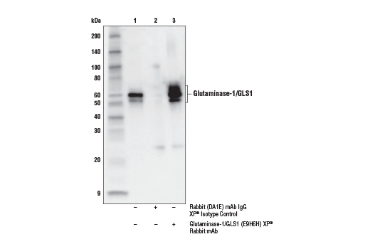 undefined Image 13: Glutamine Metabolism Antibody Sampler Kit