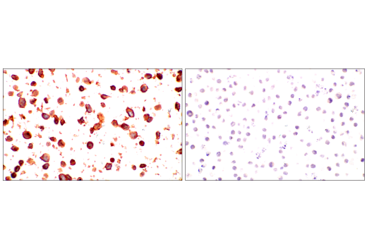 Immunohistochemistry Image 11: CD81 (D3N2D) Rabbit mAb