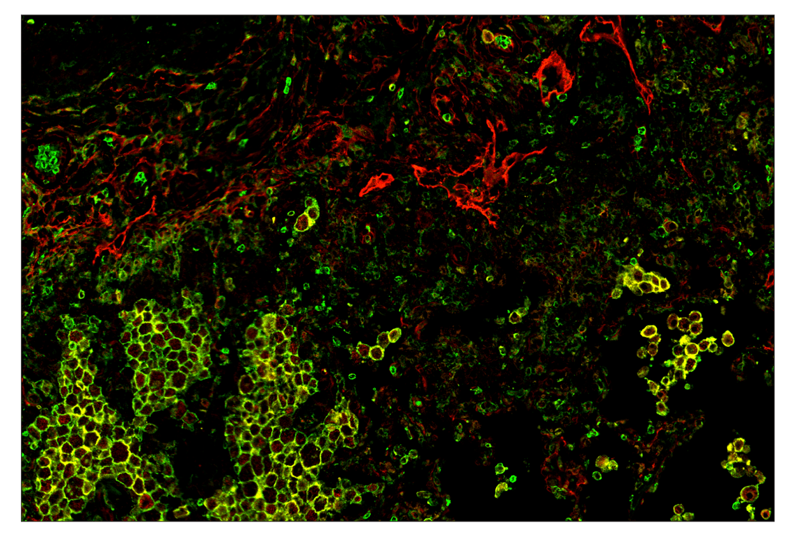 Immunohistochemistry Image 1: CD11b/ITGAM (D6X1N) & CO-0037-750 SignalStar<sup>™</sup> Oligo-Antibody Pair