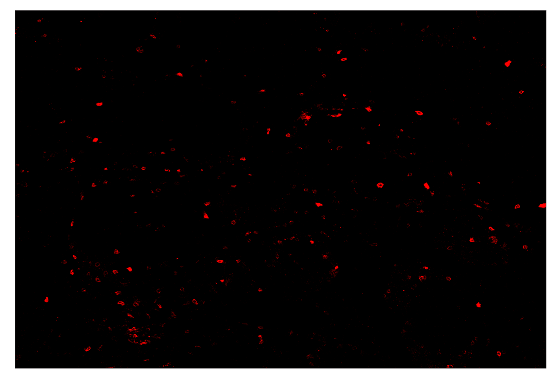 Immunohistochemistry Image 3: OX40 (E9U7O) & CO-0086-594 SignalStar<sup>™</sup> Oligo-Antibody Pair