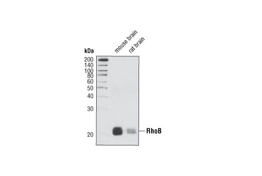 Rho-GTPase Antibody Sampler Kit: Image 1