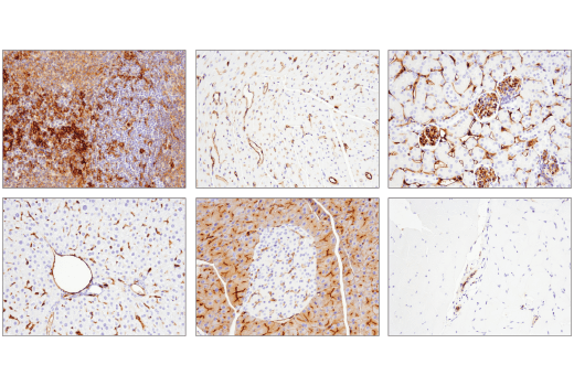 Immunohistochemistry Image 1: CD39/NTPDase 1 (E2X6B) XP<sup>®</sup> Rabbit mAb