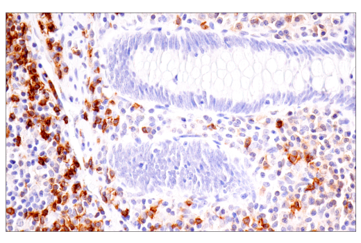 Immunohistochemistry Image 5: TNFRSF13C/BAFF-R (E3C1Q) XP<sup>®</sup> Rabbit mAb