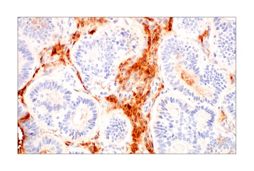 undefined Image 38: Late-Onset Alzheimer's Disease Risk Gene Antibody Sampler Kit