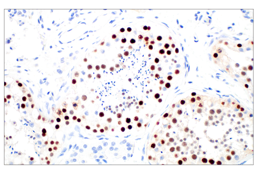 Immunohistochemistry Image 8: MAGE-C2/CT10 (E7B8D) XP<sup>®</sup> Rabbit mAb