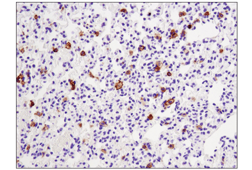 undefined Image 37: Mouse Reactive M1 vs M2 Macrophage IHC Antibody Sampler Kit