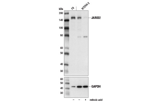 Western Blotting Image 1: JARID2 (D6M9X) Rabbit mAb