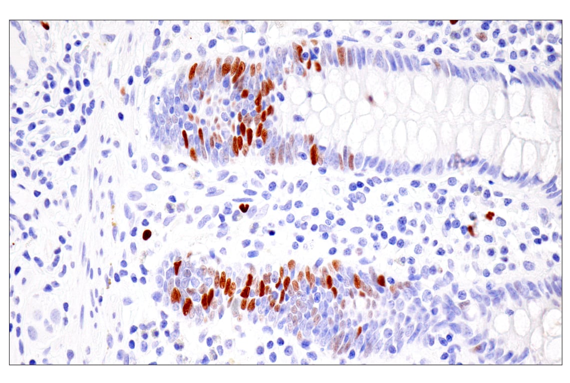Immunohistochemistry Image 12: UHRF1 (E5W8W) Rabbit mAb