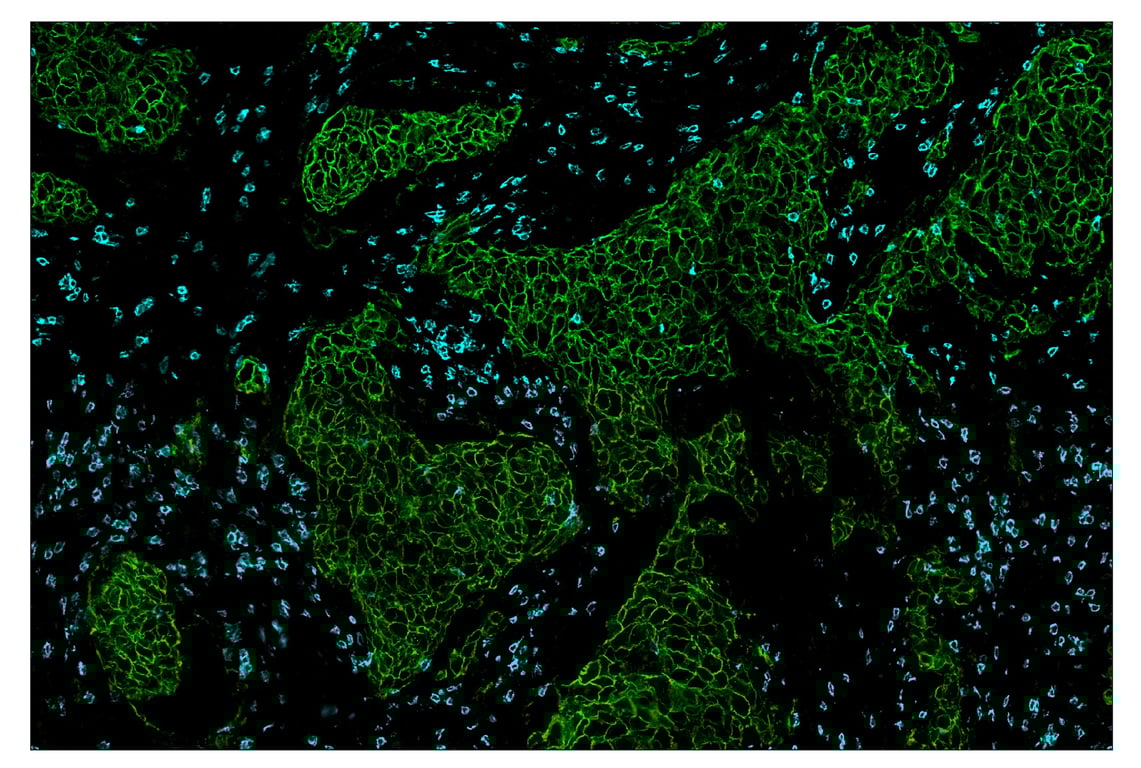 Immunohistochemistry Image 1: CD8α (D8A8Y) & CO-0004-647 SignalStar<sup>™</sup> Oligo-Antibody Pair