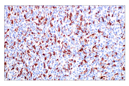 Immunohistochemistry Image 1: CD206/MRC1 (E6T5J) XP<sup>®</sup> Rabbit mAb (BSA and Azide Free)