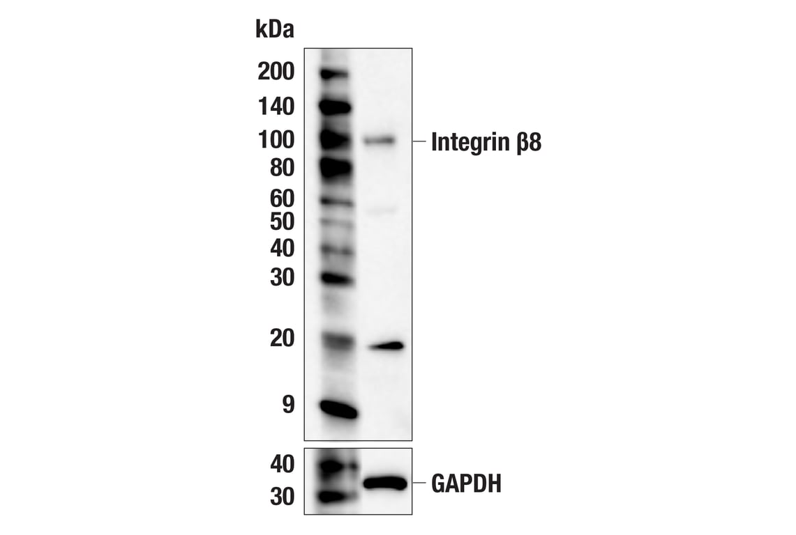 Western Blotting Image 2: Integrin β8 (F1H4B) Rabbit mAb