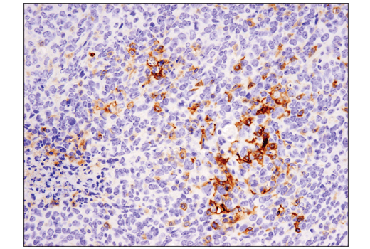 undefined Image 15: Mouse Reactive M1 vs M2 Macrophage IHC Antibody Sampler Kit