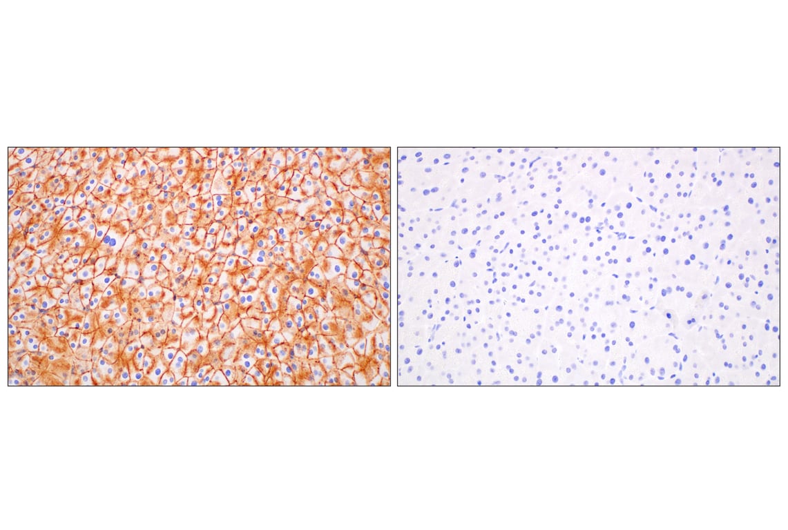 Immunohistochemistry Image 8: CD47 (E2V9V) Rabbit mAb