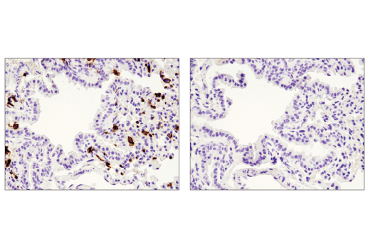 Immunohistochemistry Image 2: CD45 (D3F8Q) Rabbit mAb