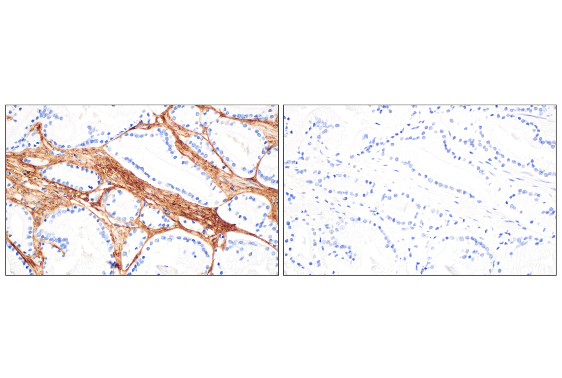 Immunohistochemistry Image 5: COL6A1 (E9U3B) Rabbit mAb (BSA and Azide Free)