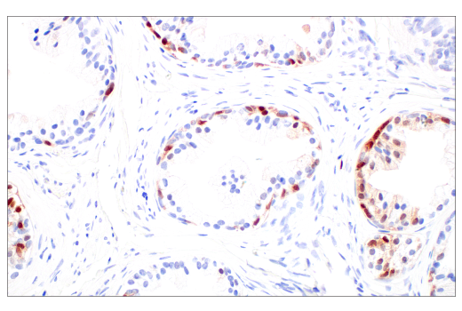 Immunohistochemistry Image 9: p16 INK4A (BC42) Mouse mAb