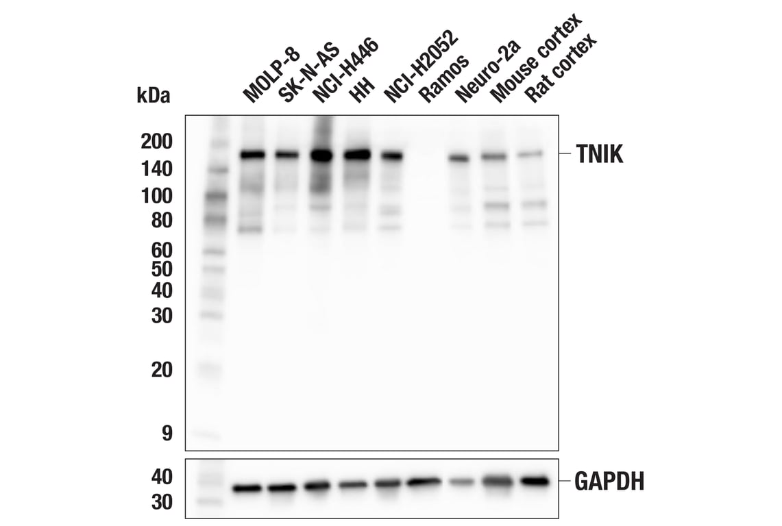 Western Blotting Image 2: TNIK (F7V3J) Rabbit mAb