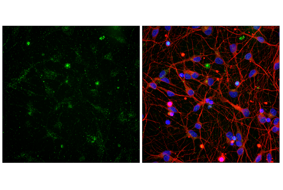 Immunofluorescence Image 1: AMPA Receptor 4 (GluA 4) (D41A11) XP<sup>®</sup> Rabbit mAb