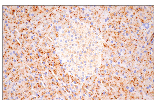 Immunohistochemistry Image 4: Cathepsin D (E7Z4L) XP<sup>®</sup> Rabbit mAb
