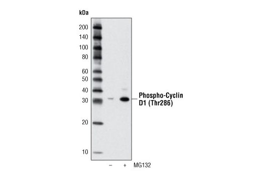 Western Blotting Image 2: Phospho-Cyclin D1 (Thr286) (D29B3) XP<sup>®</sup> Rabbit mAb