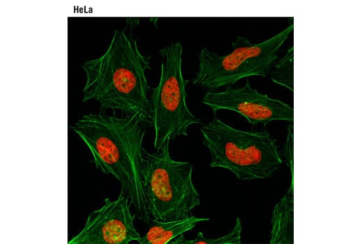 Immunofluorescence Image 1: Di-Methyl-Histone H3 (Lys27) (D18C8) XP<sup>®</sup> Rabbit mAb (Alexa Fluor<sup>®</sup> 647 Conjugate)